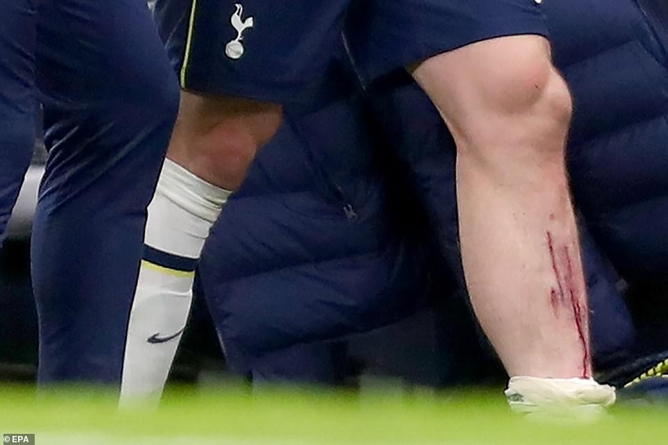 Khoảnh khắc Son Heung Min tỏa sáng đưa Tottenham vào chung kết League Cup - 6 Khoảnh khắc Son Heung Min tỏa sáng đưa Tottenham vào chung kết League Cup - 6