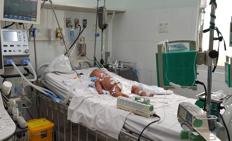 Vết muỗi chích khiến bé 9 tháng tuổi sốc nặng, nguy kịch - 1 Vết muỗi chích khiến bé 9 tháng tuổi sốc nặng, nguy kịch - 1