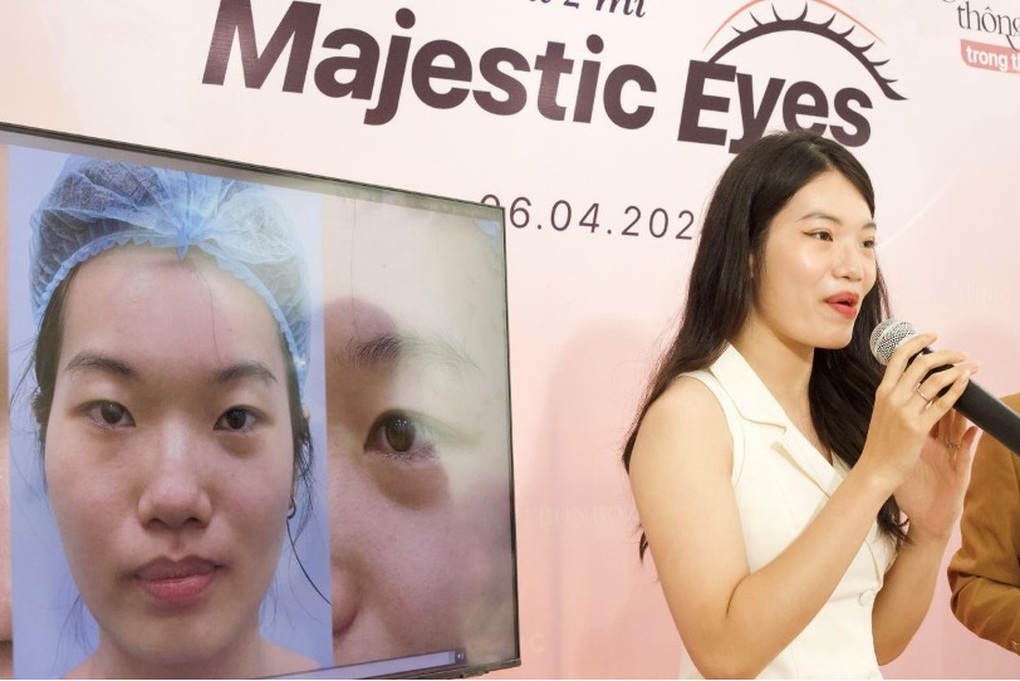 Majestic Eyes - Tạo hình mí mắt không cắt chỉ tại phòng khám BonBoz - 2