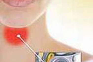 Miền Bắc: Bệnh viêm mũi - họng tăng cao