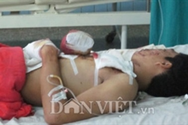 Đốt pháo, nổ nát hai bàn tay 