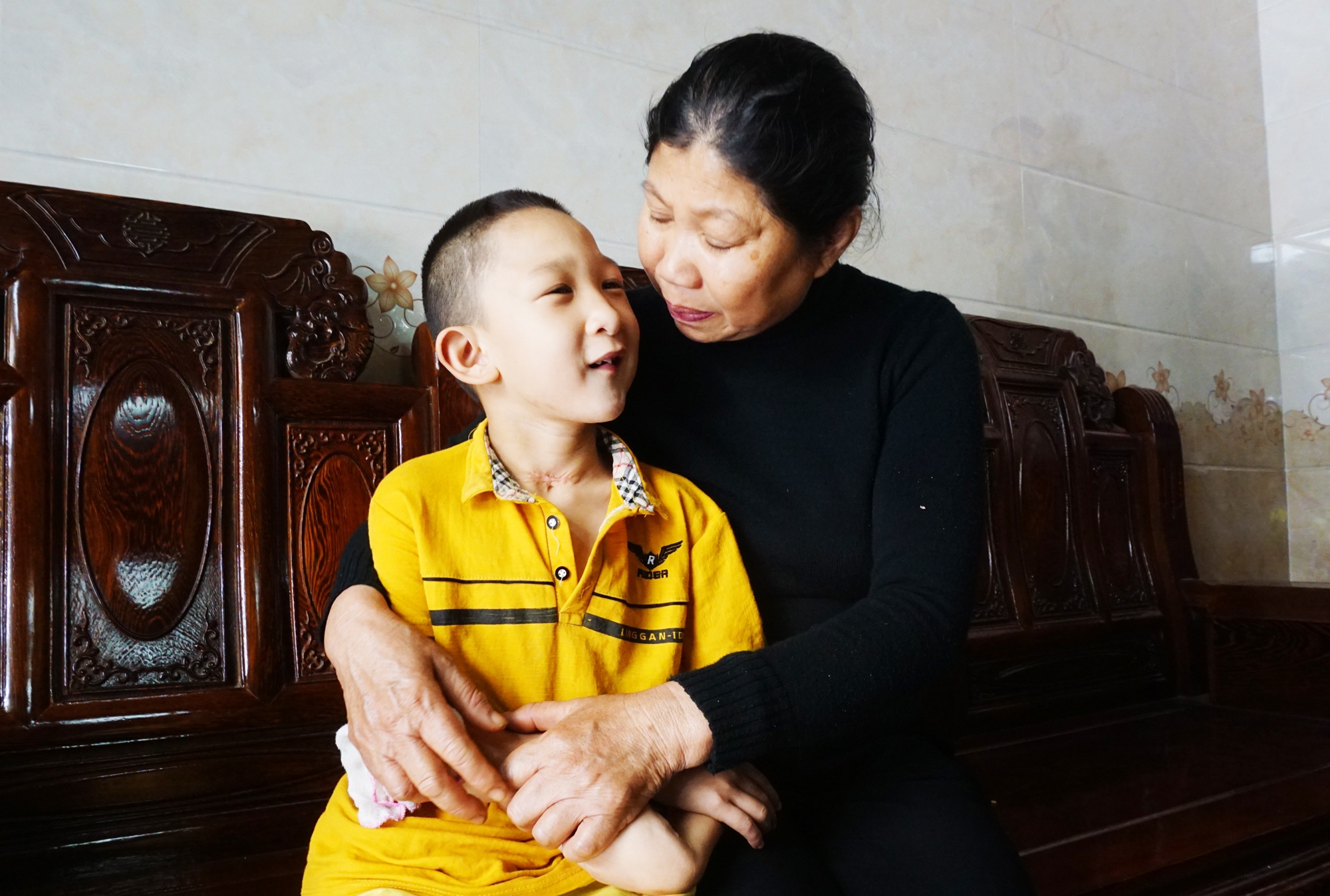 Hành trình hồi sinh đầy gian nan của cậu bé đa dị tật 2 lần bị bỏ rơi - 7 Hành trình hồi sinh đầy gian nan của cậu bé đa dị tật 2 lần bị bỏ rơi - 7