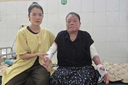 Hai nạn nhân vụ sét đánh ở Lào Cai đã hồi phục tích cực