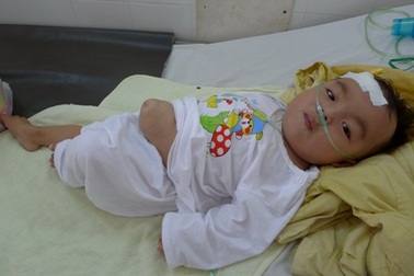 Cha mẹ bỏ đi biệt tích, bé 22 tháng tuổi thoi thóp chờ phép mầu