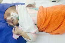 Mắc ho gà nguy hiểm, trẻ nguy kịch tính mạng