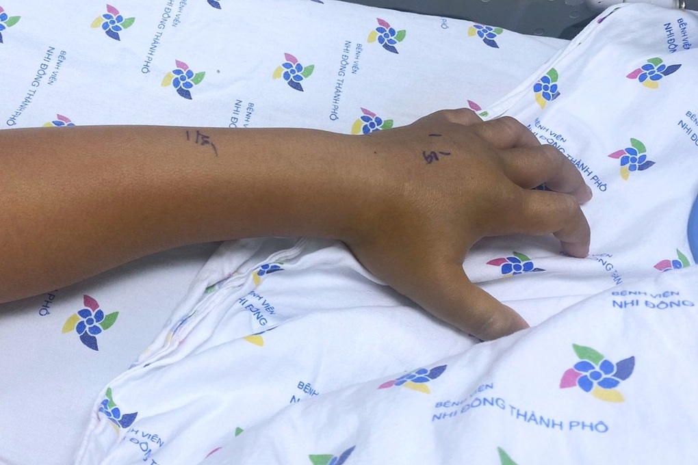 Ra sau nhà đánh răng, bé 8 tuổi bị rắn lục cắn nguy kịch ngày mùng 1 Tết - 1