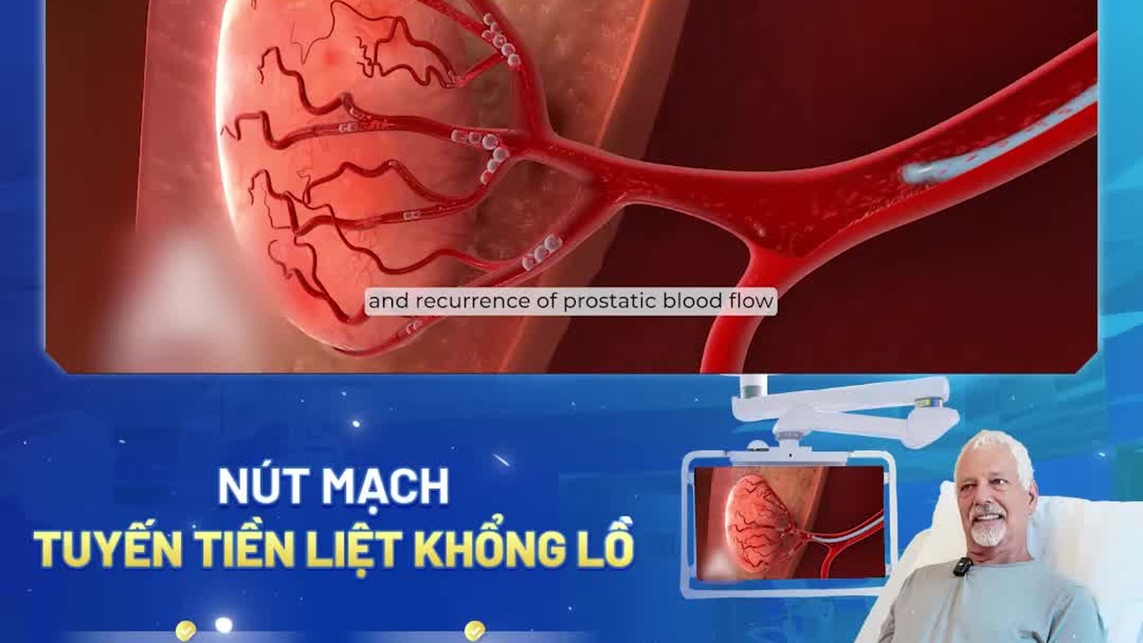 Bệnh nhân người Guatemala bay đến Việt Nam nút mạch tuyến tiền liệt
