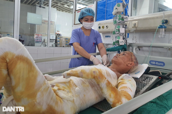 Chàng trai trẻ bốc cháy như ngọn đuốc, bỏng 71% cơ thể - 1