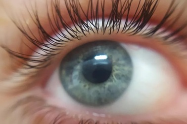 Tìm ra cách đoán được nguy cơ tử vong sớm qua mắt người bệnh?