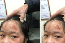 Hà Nội: Nữ sinh lớp 8 đánh em lớp 6 chảy máu mặt bị đình chỉ học một tuần