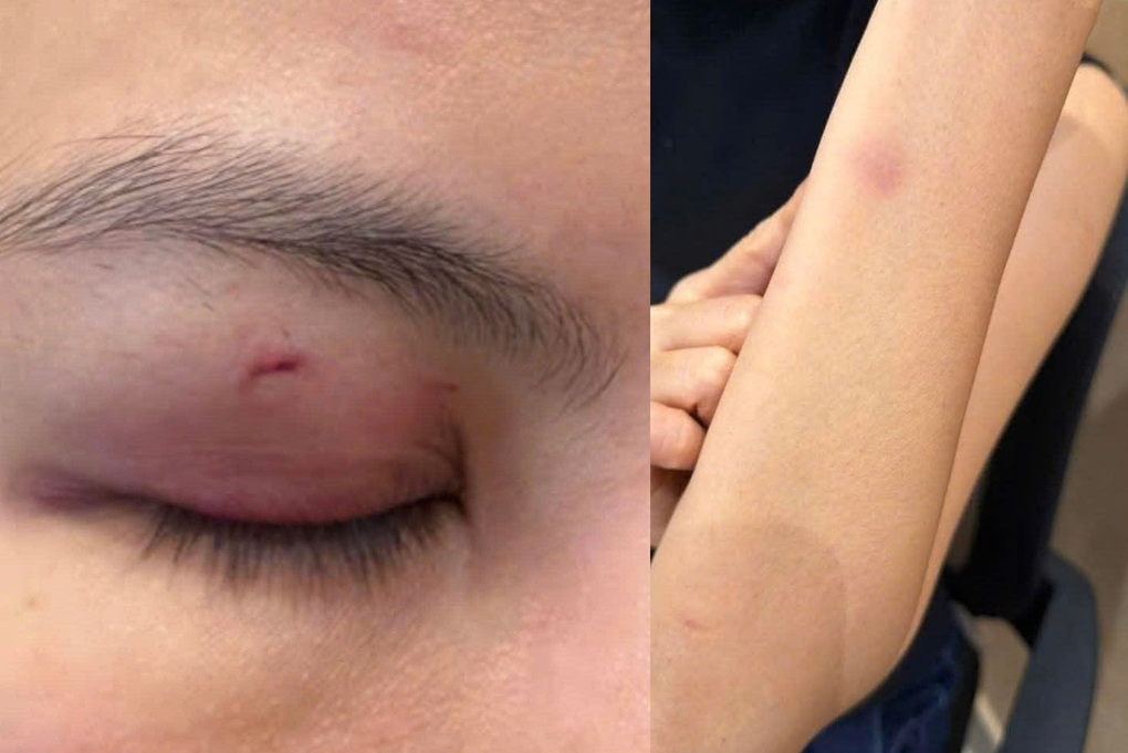 Xác minh tin tố giác ca sĩ Trung Quân Idol hành hung nữ bác sĩ ở TPHCM - 1