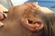 Khởi tố gã chồng dùng dao rạch nhiều nhát lên mặt vợ