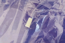 Nghe tiếng còi phát ra từ cổ họng trẻ, bác sĩ lấy ra dị vật bất ngờ