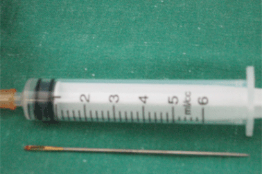 Vụ đâm kim khâu lốp ngập đầu trẻ: “Thừa” bằng chứng khởi tố vụ án giết người 