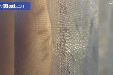 Cận cảnh muỗi tìm cách tiếp cận da người