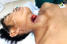 Cấp cứu kịp thời một trường hợp cắt đứt cổ tự tử