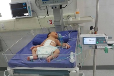 Cứu sống bé sơ sinh 1 giờ tuổi lộ nội tạng ra ngoài thành bụng