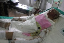  Các nạn nhân vụ cháy xưởng giày da ở Hải Phòng đang nguy kịch