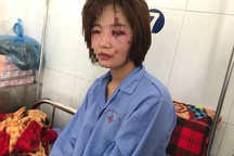 Nữ phụ xe buýt bị hành hung: "Đánh tôi xong họ vứt lại 1 triệu để... mua thuốc"