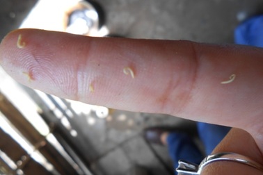 Ly kỳ chuyện đi bắt “con sâu răng”