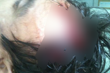 Chú ruột chém cháu chấn thương sọ não