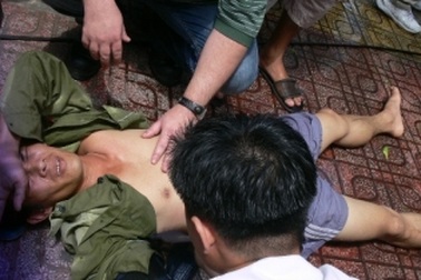 Một công nhân bị điện giật treo trên cao  