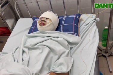 Nam sinh lớp 11 bị điện cao thế giật nguy kịch