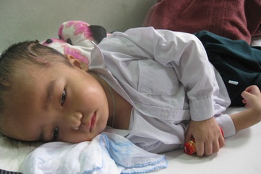 Bé Việt Anh vẫn trong tình trạng nguy hiểm