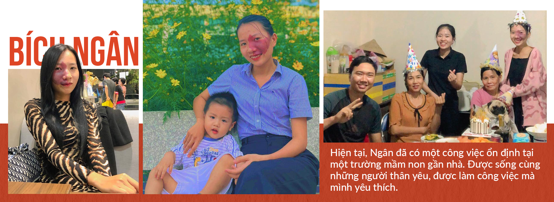Cô giáo trẻ sống vui vẻ, tự tin với vết bớt chiếm một phần tư gương mặt - 9 Cô giáo trẻ sống vui vẻ, tự tin với vết bớt chiếm một phần tư gương mặt - 9