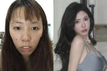 Hot girl Trung Quốc phẫn nộ khi bị tung ảnh thời còn xấu xí, chưa dao kéo