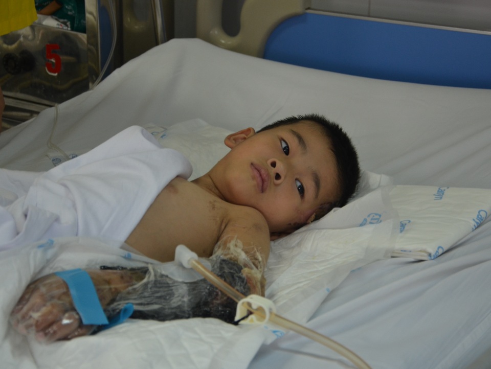 Thương cậu bé 6 tuổi bị công nông chèn dập nát cánh tay, gia đình kiệt quệ - 2 Thương cậu bé 6 tuổi bị công nông chèn dập nát cánh tay, gia đình kiệt quệ - 2