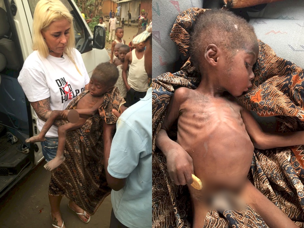 Cậu bé châu Phi trong bức ảnh chấn động thế giới 8 năm trước giờ ra sao? - 2