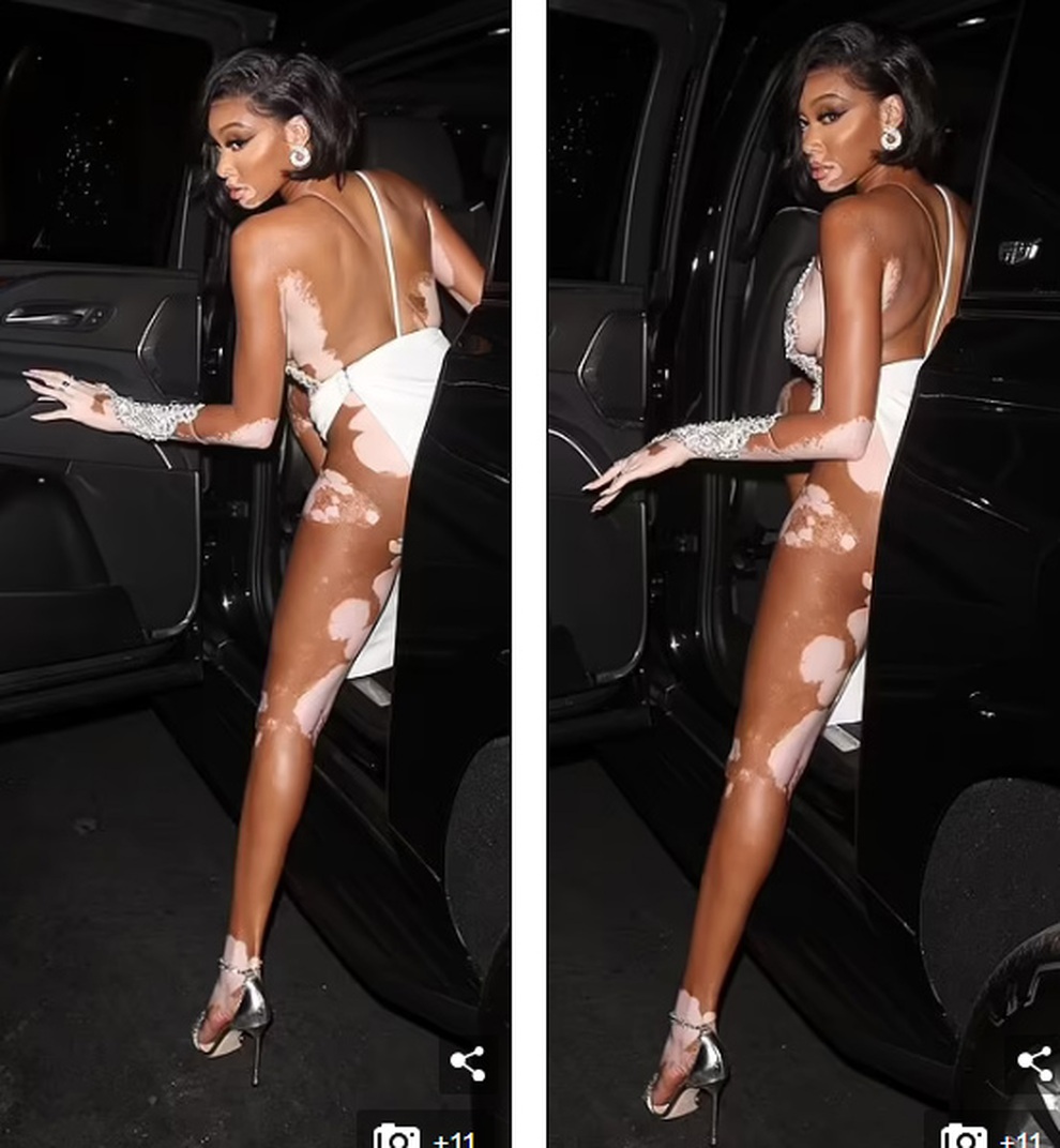 Siêu mẫu bạch biến Winnie Harlow gây choáng với váy xẻ bất tận - 4 Siêu mẫu bạch biến Winnie Harlow gây choáng với váy xẻ bất tận - 4