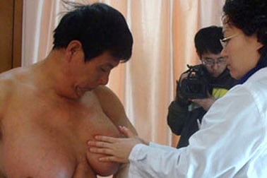 Người đàn ông có bộ ngực “khủng”