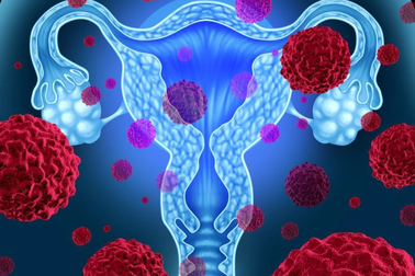 Phát hiện tế bào bất thường sau tầm soát ung thư cổ tử cung có đáng ngại?