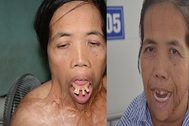 Người đàn bà có hàm răng "kì dị" lần đầu ngoái cổ sau nửa thế kỉ: "Em sợ mẹ không nhận ra"