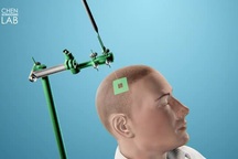 Sử dụng sóng siêu âm để chẩn đoán ung thư não