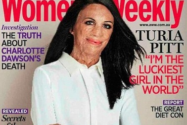 Chuyện người phụ nữ có khuôn mặt biến dạng gây xúc động mạnh