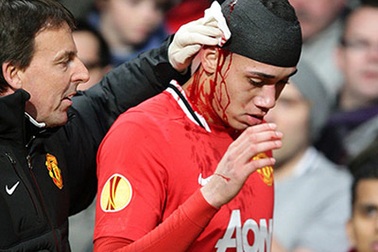 Những "dòng máu phun trào" từ cơ thể các cầu thủ bóng đá