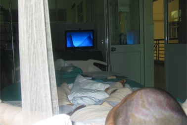 Bé bỏng vôi cần thêm ít nhất một tháng điều trị phục hồi chức năng