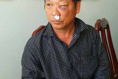 Vụ nhà báo VTV bị hành hung: Có dấu hiệu khai thác đất sét