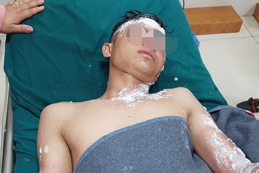 Nổ pháo, hàng loạt trường hợp nhập viện cấp cứu trong đêm giao thừa