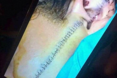 Nữ sinh lớp 11 bị đâm rách mặt vì mâu thuẫn trong buôn bán?