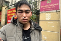 Nam shipper kể về việc bị tài xế Lexus hành hung tới tấp