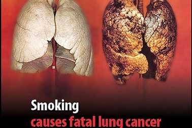 WHO kêu gọi ngăn chặn sự can thiệp của ngành công nghiệp thuốc lá