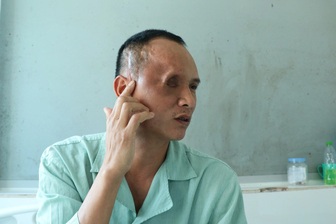 Người đàn ông mắc ung thư hiếm phải khoét một mắt, gồng gánh nuôi 3 con nhỏ