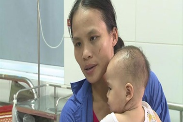 Bệnh nhi nhiễm trùng máu nặng vì bệnh Whitmore giống quai bị