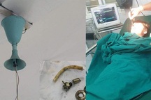 Đang ngồi trong lớp, một học sinh tiểu học bị quạt trần rơi, văng vào đầu