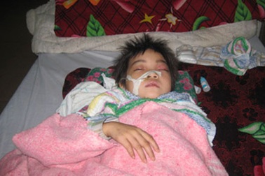 Cứu sống bé 5 tuổi mắc cùng lúc 3 bệnh nguy hiểm