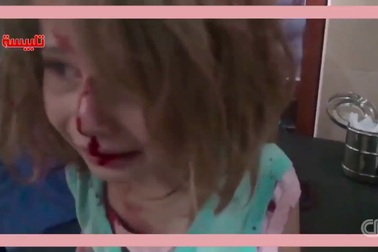 Cuộc chiến Syria: Thêm ám ảnh về nỗi đau trẻ nhỏ